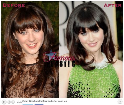 zooey deschanel facelift|Zooey Deschanels plastic surgery